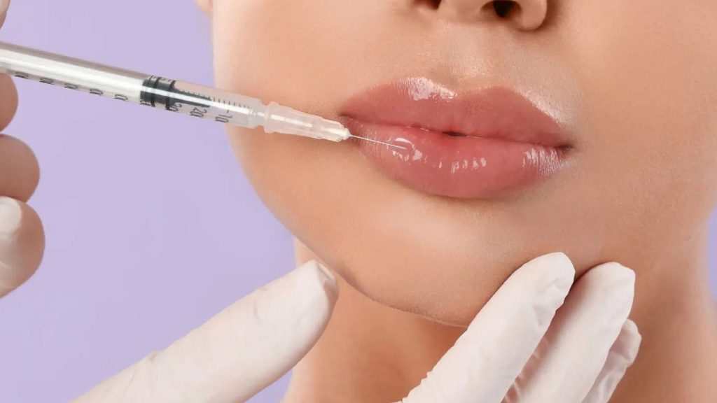 Patient undergoing lip filler in Prime Medspa Portland