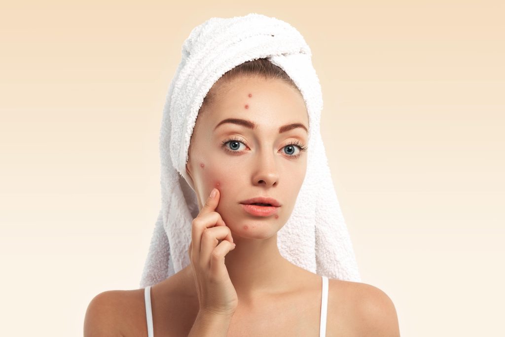 Where to Get Acne Facials Treatments in Portland